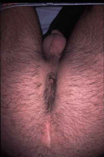 Featured bear